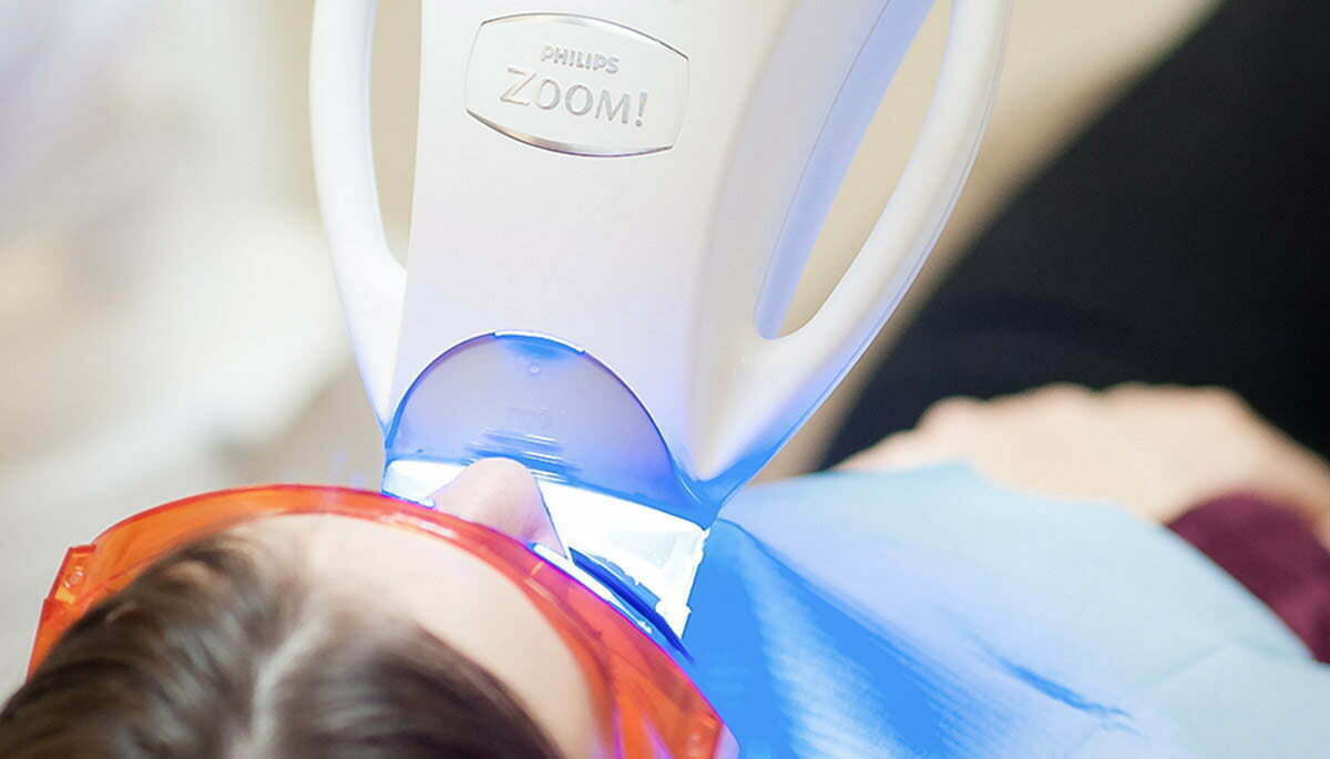 invisalign teeth whitening melbourne