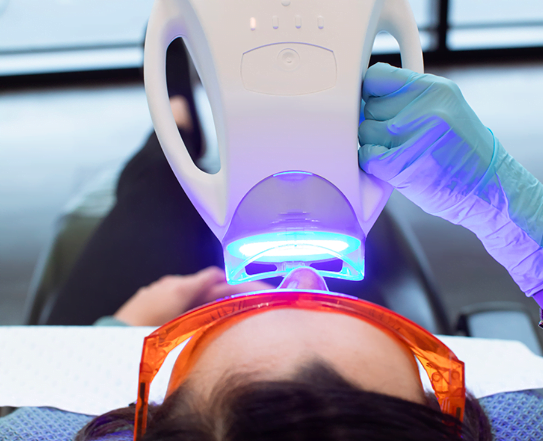 teeth whitening armadale