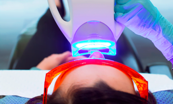 teeth whitening