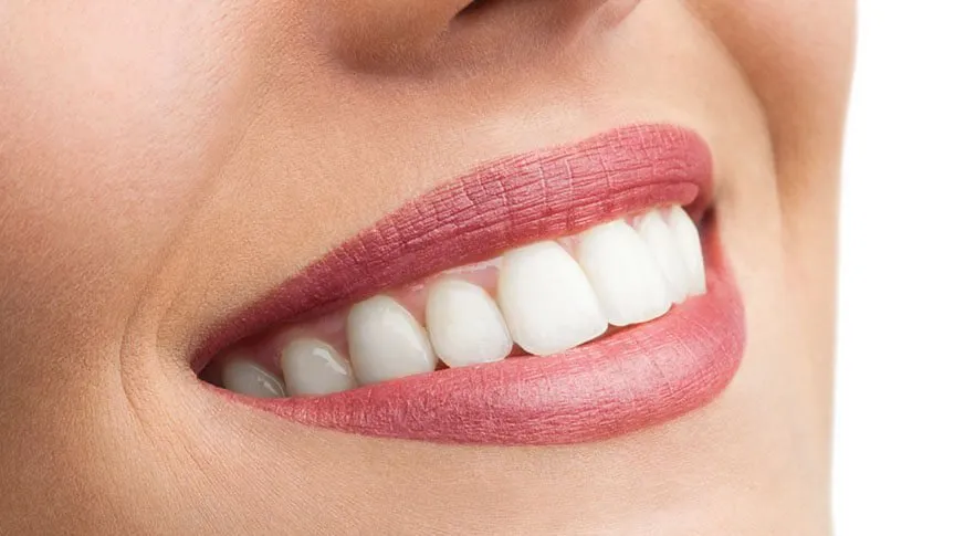 dental bonding dental bonding