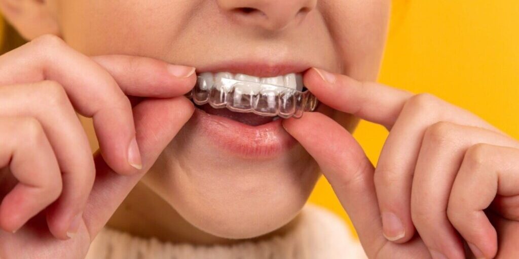 invisalign cost melbourne