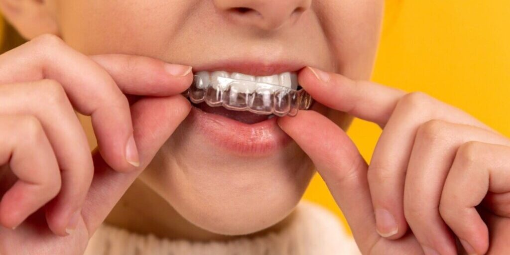 melbourne invisalign treatment